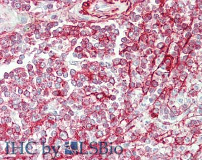 NCOA3 / SRC-3 / AIB1 Antibody - Immunohistochemistry of rabbit anti-NCOA3 antibody. Tissue: skin spleen. Fixation: formalin fixed paraffin embedded. Antigen retrieval: not required. Primary antibody: Anti-NCOA3 at 5 µg/mL for 1 h at RT. Secondary antibody: Peroxidase rabbit secondary antibody at 1:10,000 for 45 min at RT. Staining: NCOA-3 as precipitated red signal with hematoxylin purple nuclear counterstain.