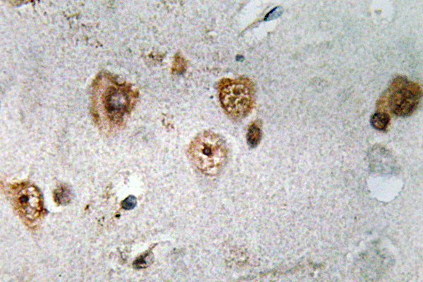 NCOA3 / SRC-3 / AIB1 Antibody - IHC of NCoA-3 (S587) pAb in paraffin-embedded human brain tissue.