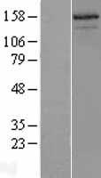 NCOA3 / SRC-3 / AIB1 Protein - Western validation with an anti-DDK antibody * L: Control HEK293 lysate R: Over-expression lysate