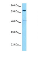 NCOA5 Antibody - NCOA5 antibody Western blot of MCF7 Cell lysate. Antibody concentration 1 ug/ml.  This image was taken for the unconjugated form of this product. Other forms have not been tested.