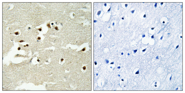 NCOA5 Antibody - Immunohistochemistry analysis of paraffin-embedded human brain tissue, using NCOA5 Antibody. The picture on the right is blocked with the synthesized peptide.