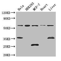 NCOA5 Antibody - Positive WB detected in:Hela whole cell lysate,HEK293 whole cell lysate,MCF-7 whole cell lysate,Mouse heart tissue,Mouse liver tissue;All lanes: NCOA5 antibody at 3ug/ml;Secondary;Goat polyclonal to rabbit IgG at 1/50000 dilution;Predicted band size: 66 kDa;Observed band size: 66,35,25 kDa;