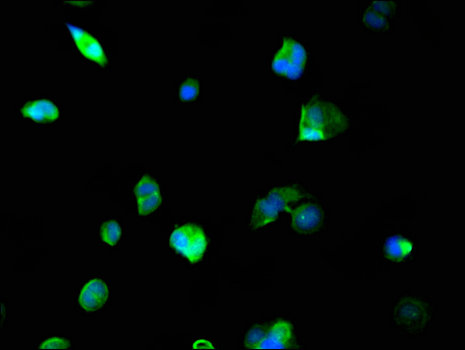 NCOA5 Antibody - Immunofluorescent analysis of MCF-7 cells using NCOA5 Antibody at a dilution of 1:100 and Alexa Fluor 488-congugated AffiniPure Goat Anti-Rabbit IgG(H+L)