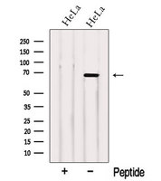 NCOA5 Antibody - Western blot analysis of extracts of HeLa cells using NCOA5 antibody. The lane on the left was treated with blocking peptide.