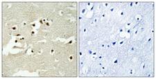 NCOA5 Antibody - Peptide - + Immunohistochemistry analysis of paraffin-embedded human brain tissue using NCOA5 antibody.