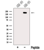 NCOA6 / ASC-2 Antibody - Western blot analysis of extracts of HEK293 cells using NCOA6 antibody. The lane on the left was treated with blocking peptide.