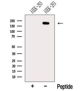 NCOA6 / ASC-2 Antibody - Western blot analysis of extracts of HEK293 cells using NCOA6 antibody. The lane on the left was treated with blocking peptide.