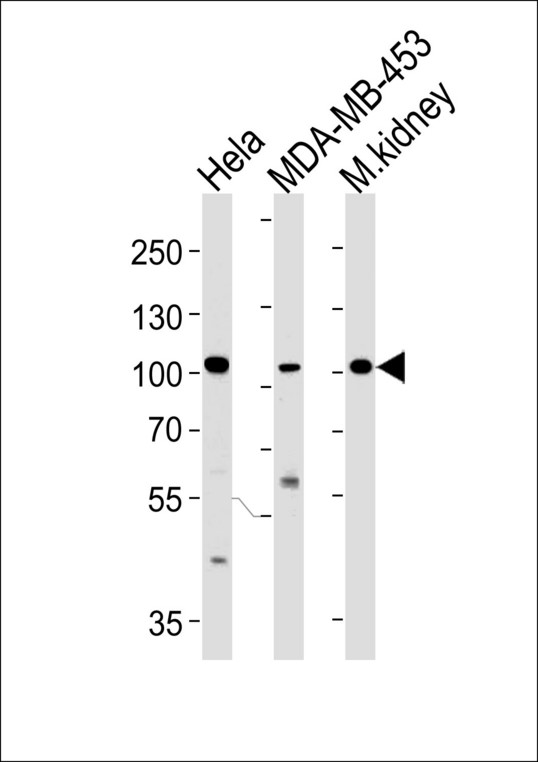 NCOA7 Antibody - NCOA7 Antibody western blot of HeLa,MDA-MB-453 cell line and mouse kidney tissue lysates (35 ug/lane). The NCOA7 antibody detected the NCOA7 protein (arrow).