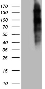 NCOA7 Antibody - HEK293T cells were transfected with the pCMV6-ENTRY control. (Left lane) or pCMV6-ENTRY NCOA7. (Right lane) cDNA for 48 hrs and lysed. Equivalent amounts of cell lysates. (5 ug per lane) were separated by SDS-PAGE and immunoblotted with anti-NCOA7. (1:2000)