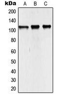 NCOA7 Antibody - Western blot analysis of NCOA7 expression in HEK293T (A); mouse kidney (B); rat kidney (C) whole cell lysates.