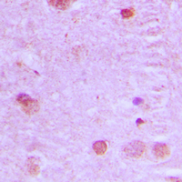 NCOA7 Antibody - Immunohistochemical analysis of NCOA7 staining in human brain formalin fixed paraffin embedded tissue section. The section was pre-treated using heat mediated antigen retrieval with sodium citrate buffer (pH 6.0). The section was then incubated with the antibody at room temperature and detected using an HRP conjugated compact polymer system. DAB was used as the chromogen. The section was then counterstained with hematoxylin and mounted with DPX.