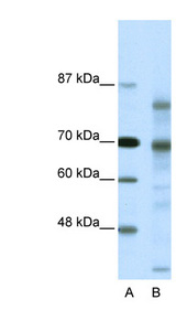 NCOR2 / SMRT Antibody - NCOR2 antibody Western blot of HeLa lysate. This image was taken for the unconjugated form of this product. Other forms have not been tested.
