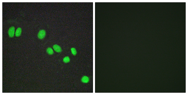 NCOR2 / SMRT Antibody - Immunofluorescence analysis of A549 cells, using NCOR2 Antibody. The picture on the right is blocked with the synthesized peptide.
