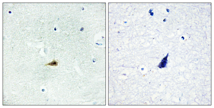 NCOR2 / SMRT Antibody - Immunohistochemistry analysis of paraffin-embedded human brain tissue, using NCOR2 Antibody. The picture on the right is blocked with the synthesized peptide.