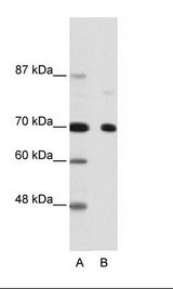 NCOR2 / SMRT Antibody - A: Marker, B: Hela Cell Lysate.  This image was taken for the unconjugated form of this product. Other forms have not been tested.