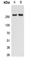 NCOR2 / SMRT Antibody - Western blot analysis of SMRT expression in HeLa (A); HEK293T (B) whole cell lysates.