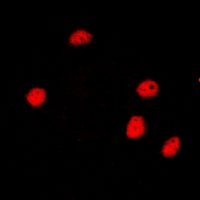 NCOR2 / SMRT Antibody - Immunofluorescent analysis of SMRT staining in HeLa cells. Formalin-fixed cells were permeabilized with 0.1% Triton X-100 in TBS for 5-10 minutes and blocked with 3% BSA-PBS for 30 minutes at room temperature. Cells were probed with the primary antibody in 3% BSA-PBS and incubated overnight at 4 deg C in a humidified chamber. Cells were washed with PBST and incubated with a DyLight 594-conjugated secondary antibody (red) in PBS at room temperature in the dark. DAPI was used to stain the cell nuclei (blue).