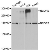 NCOR2 / SMRT Antibody - Western blot analysis of extracts of various cell lines.