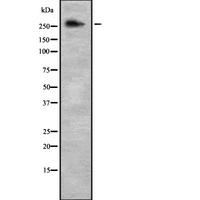 NCOR2 / SMRT Antibody - Western blot analysis NCOR2 using NIH-3T3 whole cells lysates