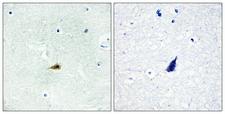 NCOR2 / SMRT Antibody - Peptide - + Immunohistochemistry analysis of paraffin-embedded human brain tissue, using NCOR2 antibody.