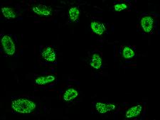 NCOR2 / SMRT Antibody - Immunofluorescence staining of NCOR2 in HeLa cells. Cells were fixed with 4% PFA, permeabilzed with 0.3% Triton X-100 in PBS, blocked with 10% serum, and incubated with rabbit anti-Human NCOR2 polyclonal antibody (dilution ratio 1:1000) at 4°C overnight. Then cells were stained with the Alexa Fluor 488-conjugated Goat Anti-rabbit IgG secondary antibody (green). Positive staining was localized to nucleus.