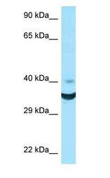 NCR1 / NKP46 Antibody - NCR1 / NKP46 antibody Western Blot of HCT15.  This image was taken for the unconjugated form of this product. Other forms have not been tested.
