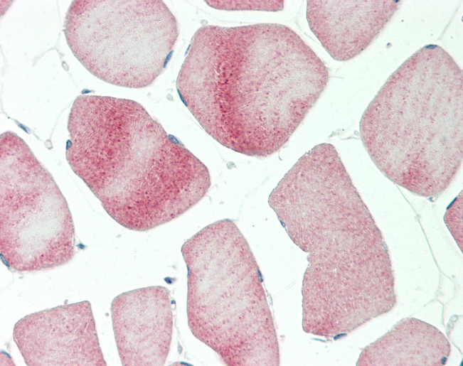 NCR1 / NKP46 Antibody - Human Skeletal Muscle: Formalin-Fixed, Paraffin-Embedded (FFPE).  This image was taken for the unconjugated form of this product. Other forms have not been tested.