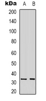NCR1 / NKP46 Antibody - Western blot analysis of CD335 expression in A431 (A); SKOV3 (B) whole cell lysates.