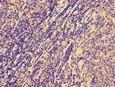NCR1 / NKP46 Antibody - Immunohistochemistry image of paraffin-embedded human lymph node tissue at a dilution of 1:100
