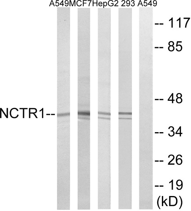 NCR1 / NKP46 Antibody - Western blot analysis of lysates from 293, HepG2, MCF-7, and A549 cells, using NCR1 Antibody. The lane on the right is blocked with the synthesized peptide.