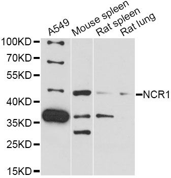NCR1 / NKP46 Antibody - Western blot analysis of extracts of various cell lines, using NCR1 antibody at 1:3000 dilution. The secondary antibody used was an HRP Goat Anti-Rabbit IgG (H+L) at 1:10000 dilution. Lysates were loaded 25ug per lane and 3% nonfat dry milk in TBST was used for blocking. An ECL Kit was used for detection and the exposure time was 90s.