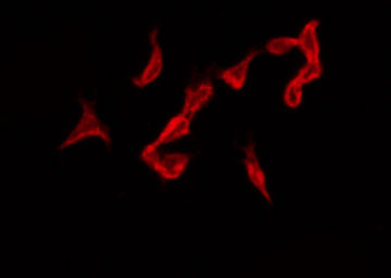 NCR1 / NKP46 Antibody - Staining 293 cells by IF/ICC. The samples were fixed with PFA and permeabilized in 0.1% Triton X-100, then blocked in 10% serum for 45 min at 25°C. The primary antibody was diluted at 1:200 and incubated with the sample for 1 hour at 37°C. An Alexa Fluor 594 conjugated goat anti-rabbit IgG (H+L) Ab, diluted at 1/600, was used as the secondary antibody.