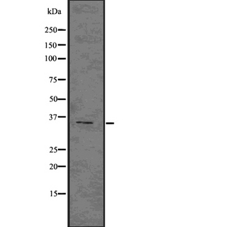NCR1 / NKP46 Antibody - Western blot analysis NKp46 using COLO205 whole cells lysates
