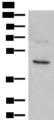 NCR1 / NKP46 Antibody - Western blot analysis of SKOV3 cell lysate  using NCR1 Polyclonal Antibody at dilution of 1:350