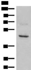 NCR1 / NKP46 Antibody - Western blot analysis of SKOV3 cell lysate  using NCR1 Polyclonal Antibody at dilution of 1:350