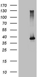 NCR2 / NKP44 Antibody - HEK293T cells were transfected with the pCMV6-ENTRY control. (Left lane) or pCMV6-ENTRY NCR2. (Right lane) cDNA for 48 hrs and lysed. Equivalent amounts of cell lysates. (5 ug per lane) were separated by SDS-PAGE and immunoblotted with anti-NCR2. (1:2000)