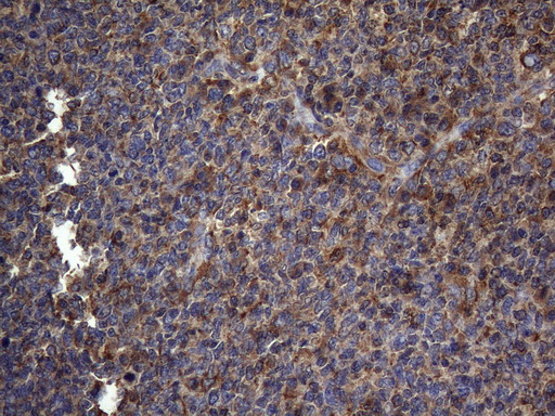 NCR2 / NKP44 Antibody - Immunohistochemical staining of paraffin-embedded Human tonsil within the normal limits using anti-NCR2 mouse monoclonal antibody. (Heat-induced epitope retrieval by 1mM EDTA in 10mM Tris buffer. (pH8.5) at 120°C for 3 min. (1:150)