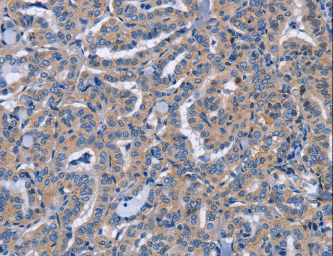 NCR2 / NKP44 Antibody - Immunohistochemistry of paraffin-embedded Human brain using NCR2 Polyclonal Antibody at dilution of 1:60.