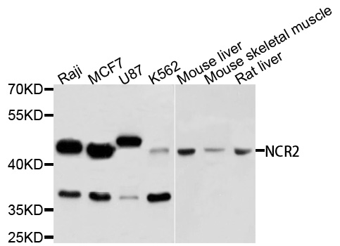 NCR2 / NKP44 Antibody - Western blot analysis of extracts of various cells.