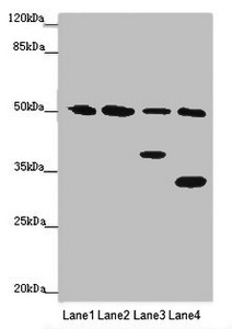 NCR3LG1 / B7H6 Antibody - Western blot All Lanes :B7H6 antibody at 2 ug/ml Lane 1 : Mouse heart tissue Lane 2 : Mouse liver tissue Lane 3 : Mouse brain tissue Lane 4 : Hela whole cell lysate Secondary Goat polyclonal to Rabbit IgG at 1/10000 dilution Predicted band size: 51 kDa Observed band size: 51,38,32 kDa
