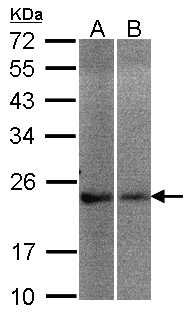 NCS1 / Neuronal Calcium Sensor Antibody - Sample (30 ug of whole cell lysate). A: A431, B: Hep G2. 12% SDS PAGE. NCS-1 antibody diluted at 1:200