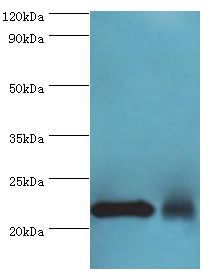 NCS1 / Neuronal Calcium Sensor Antibody - Western blot. All lanes: Neuronal calcium sensor 1 antibody at 10 ug/ml. Lane 1: HeLa whole cell lysate. Lane 2: rat kidney tissue. Secondary antibody: Goat polyclonal to rabbit at 1:10000 dilution. Predicted band size: 22 kDa. Observed band size: 22 kDa Immunohistochemistry.