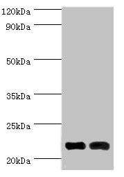NCS1 / Neuronal Calcium Sensor Antibody - Western blot All lanes: Neuronal calcium sensor 1 antibody at 10µg/ml Lane 1: Hela whole cell lysate Lane 2: Rat kidney tissue Secondary Goat polyclonal to rabbit IgG at 1/10000 dilution Predicted band size: 22, 20 kDa Observed band size: 22 kDa