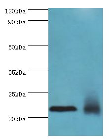 NCS1 / Neuronal Calcium Sensor Antibody - Western blot. All lanes: Neuronal calcium sensor 1 antibody at 10 ug/ml. Lane 1: HeLa whole cell lysate. Lane 2: rat kidney tissue. Secondary antibody: Goat polyclonal to rabbit at 1:10000 dilution. Predicted band size: 22 kDa. Observed band size: 22 kDa.