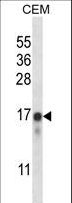 NCS1 / Neuronal Calcium Sensor Antibody - FREQ Antibody western blot of CEM cell line lysates (35 ug/lane). The FREQ antibody detected the FREQ protein (arrow).