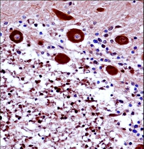NCS1 / Neuronal Calcium Sensor Antibody - FREQ Antibody immunohistochemistry of formalin-fixed and paraffin-embedded human cerebellum tissue followed by peroxidase-conjugated secondary antibody and DAB staining.