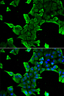 NCS1 / Neuronal Calcium Sensor Antibody - Immunofluorescence analysis of A549 cells.