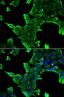 NCS1 / Neuronal Calcium Sensor Antibody - Immunofluorescence analysis of A549 cells using NCS1 antibody. Blue: DAPI for nuclear staining.