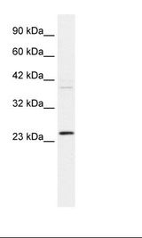 NCS1 / Neuronal Calcium Sensor Antibody - HepG2 Cell Lysate.  This image was taken for the unconjugated form of this product. Other forms have not been tested.