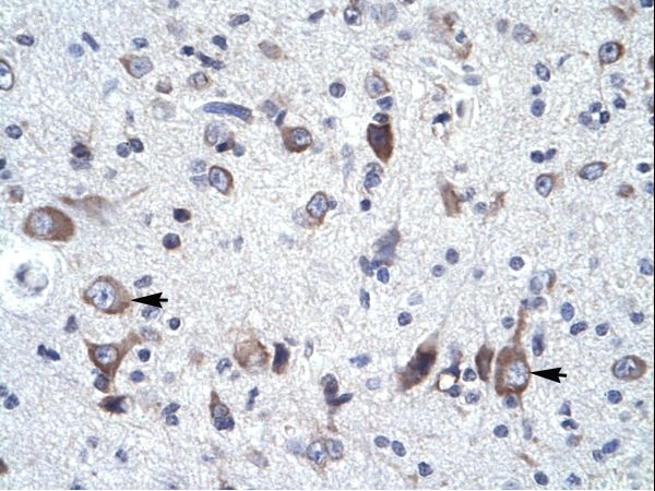 NCS1 / Neuronal Calcium Sensor Antibody - NCS1 / NCS-1 antibody ARP34315_P050-NP_055101-FREQ (frequenin homolog (Drosophila)) Antibody was used in IHC to stain formalin-fixed, paraffin-embedded human brain.  This image was taken for the unconjugated form of this product. Other forms have not been tested.